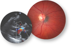http://chronicrenalinsufficiencycohort.org/Chronic-Kidney-Disease/Chronic-Renal-Insufficiency-Cohort-Study/uploads/images/photos/cric-bibliography.png